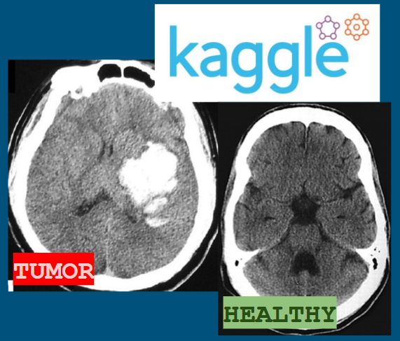 Tumor Detection